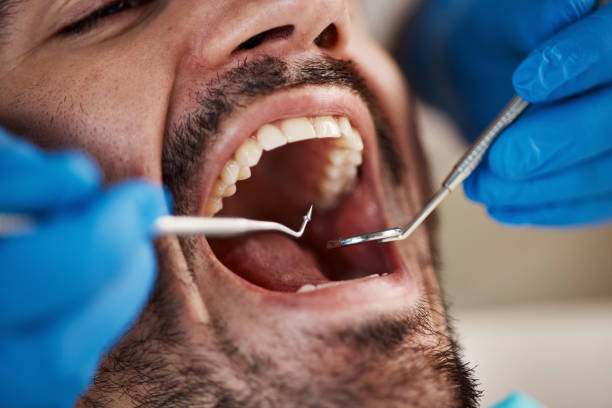Best Emergency Dental Care for Broken or Chipped Teeth in Brunswick, NC