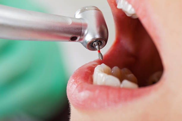 Best Emergency Denture Repair in Brunswick, NC